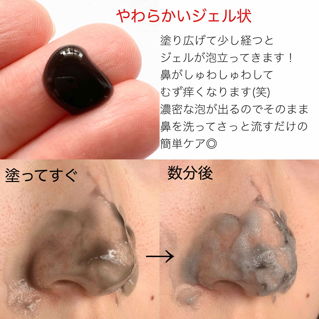 JUSO KURO PACK/NAKUNA-RE/洗い流すパック・マスクを使ったクチコミ（2枚目）