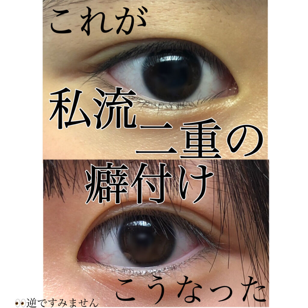 のびるアイテープ/セリア/二重まぶた用アイテムを使ったクチコミ（2枚目）