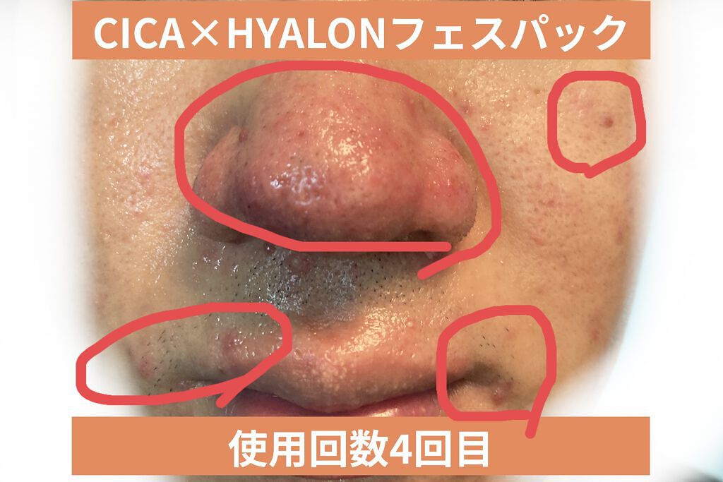 を使ったクチコミ（1枚目）