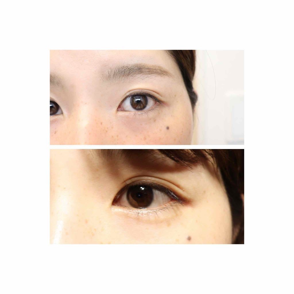 フリーファイバー120 スタンダードタイプ /メザイク/二重まぶた用アイテムを使ったクチコミ（3枚目）