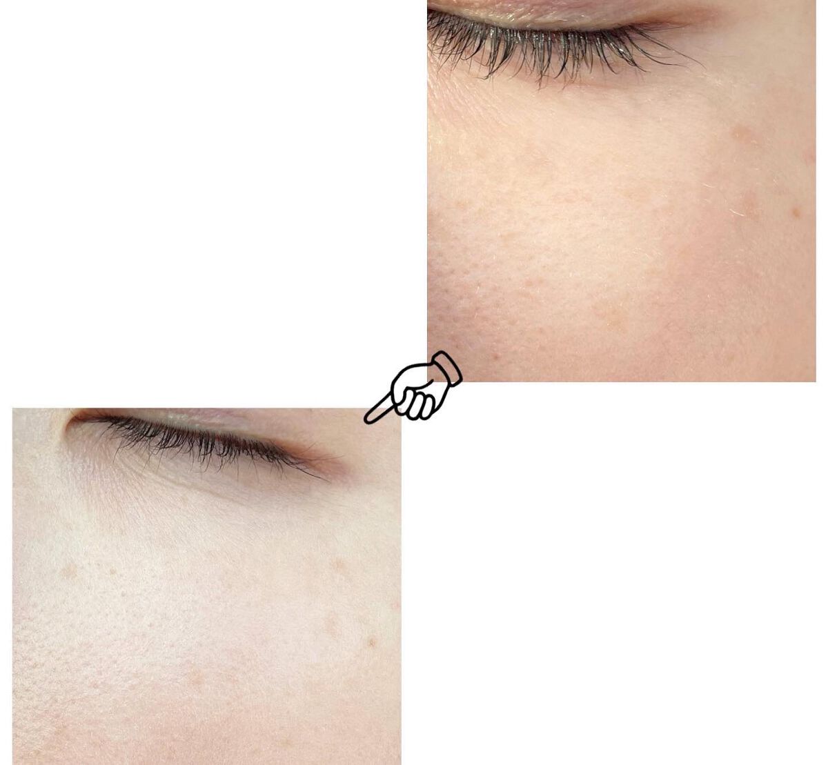 デュイセル ターンオンクリーム/DEWYCEL/フェイスクリームを使ったクチコミ(3枚目)