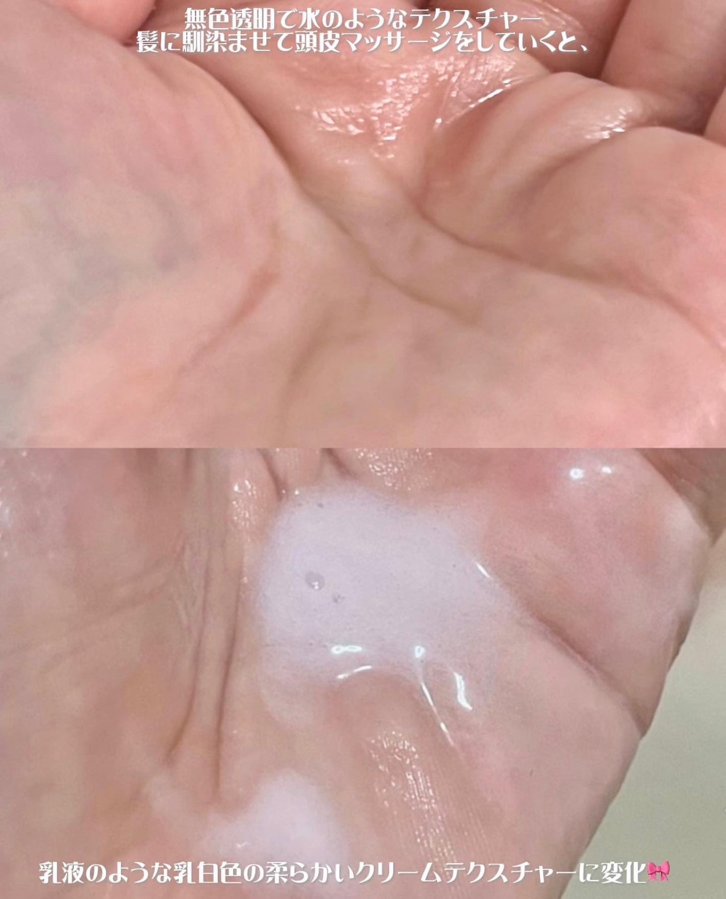 フォルテ アンプル トリートメント/treecell/洗い流すヘアトリートメントを使ったクチコミ(4枚目)