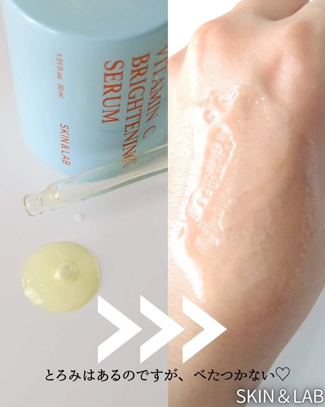 ビタミンBハイドレイティングジェルクリーム/SKIN&LAB/フェイスクリームを使ったクチコミ（3枚目）