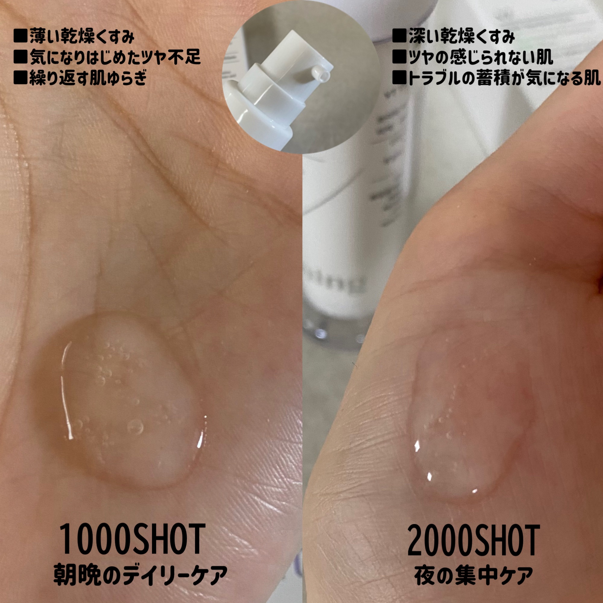 TXトーニングエッセンス2000/VT/美容液を使ったクチコミ（3枚目）