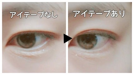 ふたえテープ 目立たず肌になじむ絆創膏タイプ/DAISO/二重まぶた用アイテムを使ったクチコミ(2枚目)