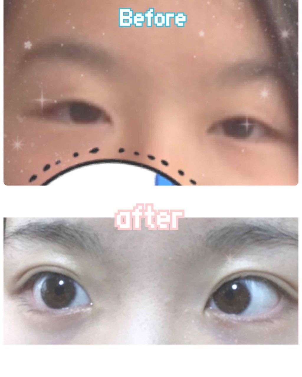 Eye棒 主婦の友社の口コミ 2枚目beforeafterです どうも By 抹茶 敏感肌 10代後半 Lips