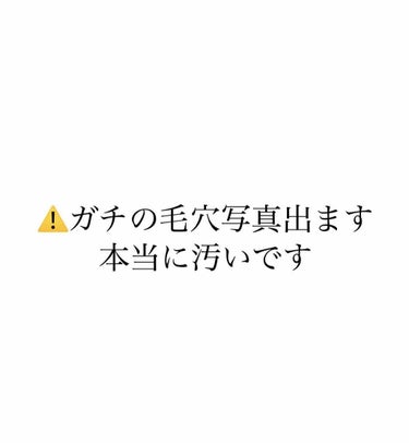 毛穴綺麗になった！！！！！！！😭

え〜聞いて欲しいもうこんな恥ずかしいこと周りの友達に言えないからここに書くねうわ〜本当に嬉しい！！！


長年！！ずっと毛穴の汚さに並んでたの！！
出かけた時にトイレ