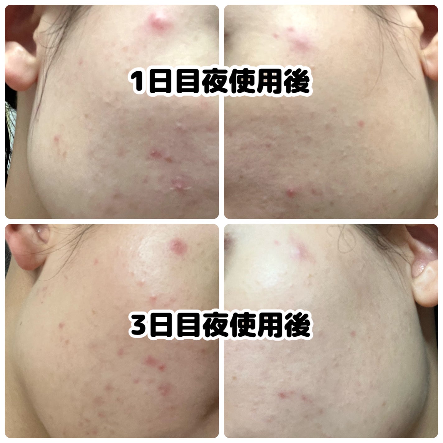 ベリーお元気?/ラッシュ/洗い流すパック・マスクを使ったクチコミ(6枚目)