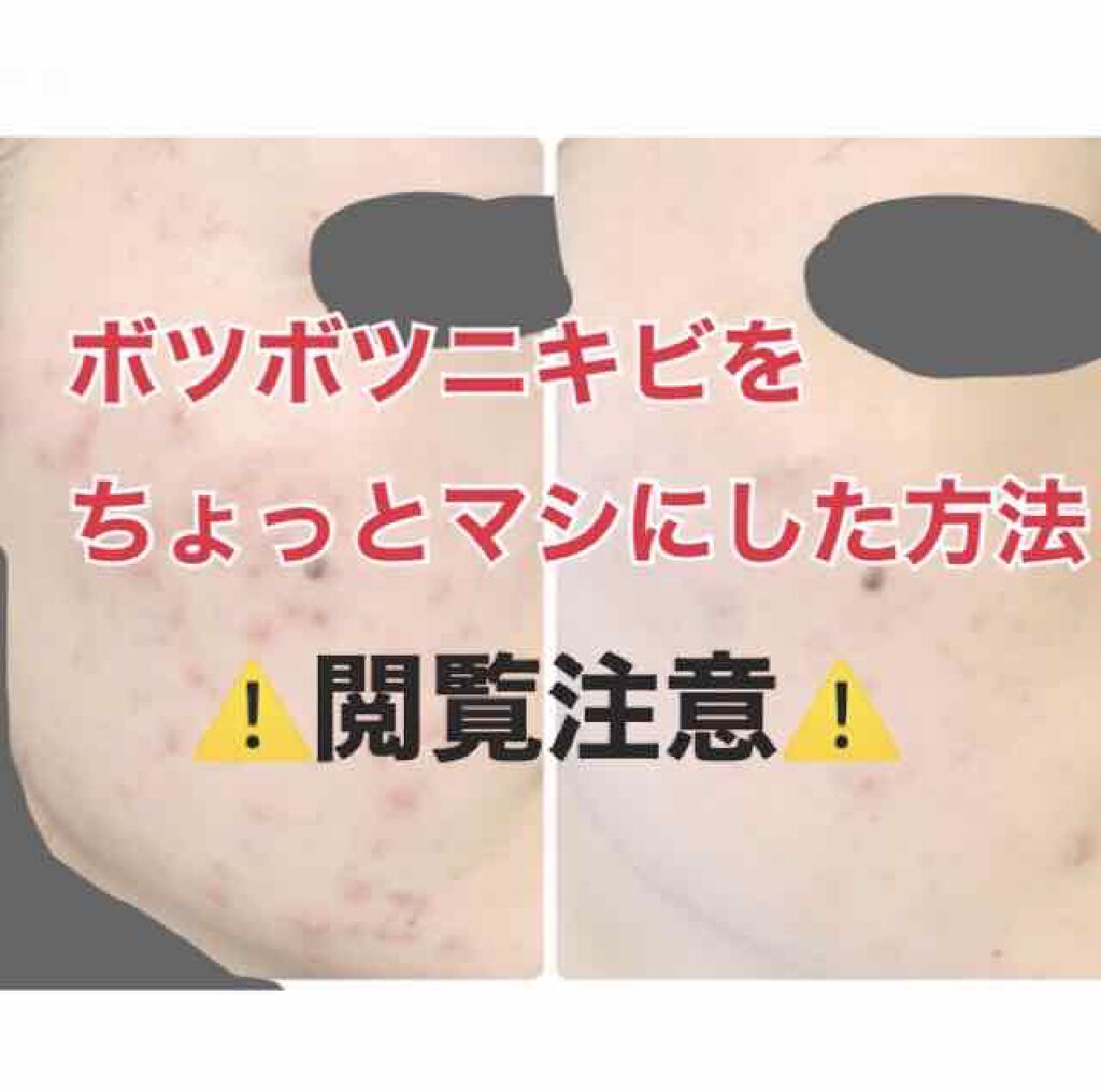 草花木果 アクネ保湿液 さっぱり(医薬部外品)/草花木果/美容液を使ったクチコミ（1枚目）