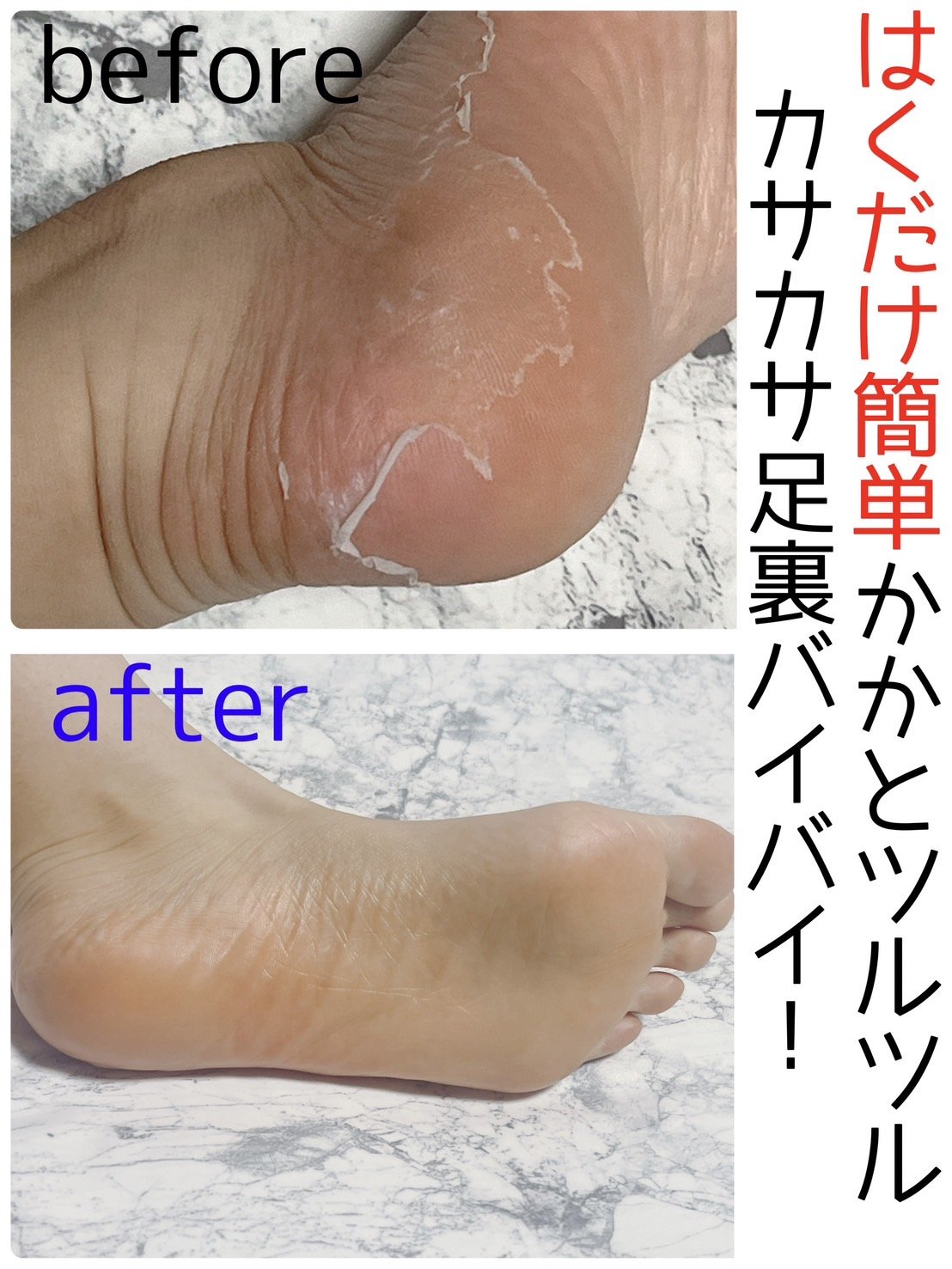 MYM 足裏ランラン エキスプレスのクチコミ「

はくだけ簡単、かかとツルツル！

足裏角質パック 

やってみたいと思いながらも
購入して.....」（1枚目）