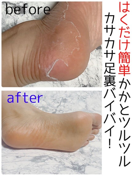 足裏ランラン エキスプレス/MYM/レッグ・フットケアを使ったクチコミ(1枚目)