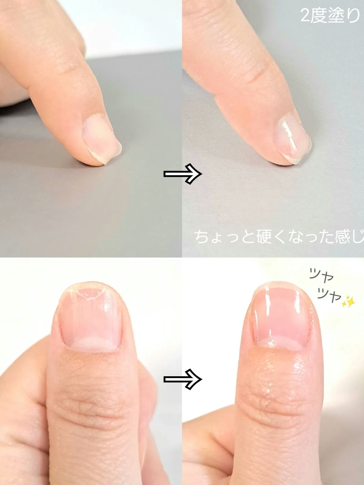 ストロングガード/D-UP/ネイル・ネイルケアを使ったクチコミ(2枚目)