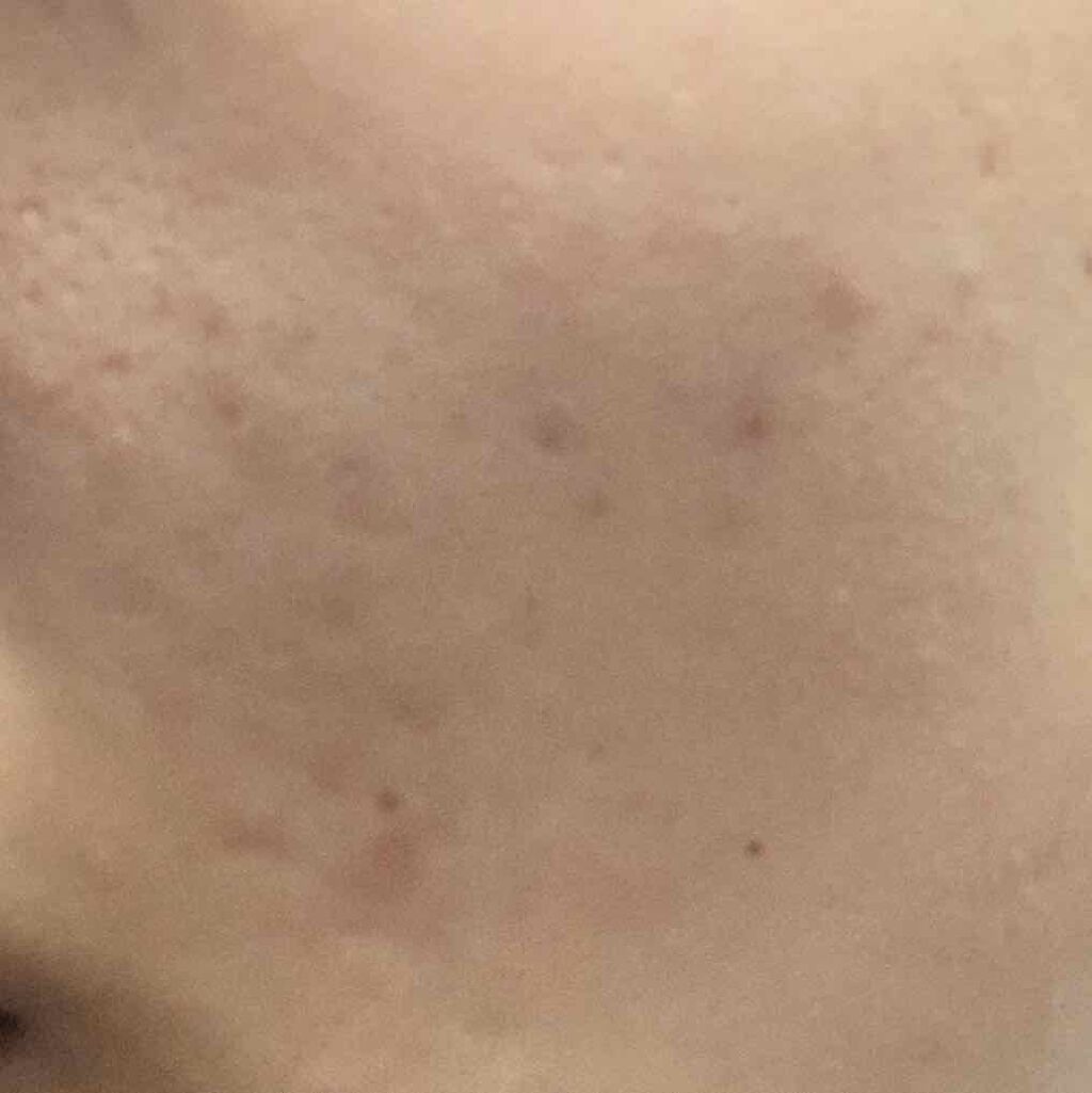 QuSomeモイスチャーリッチクリーム/b.glen/フェイスクリームを使ったクチコミ（3枚目）