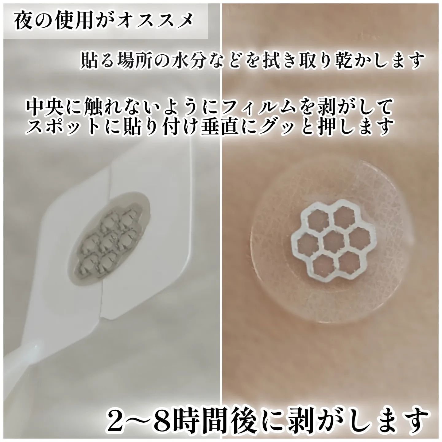 イージーダムビューティー クイックカーミング パッチのクチコミ「\そのニキビ一刻も早く直したい！/
@daewoong_qoo10_official のイージ.....」（3枚目）