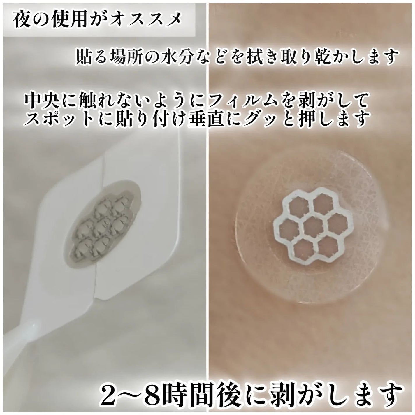 クイックカーミング パッチ/イージーダムビューティー/その他スキンケアを使ったクチコミ(3枚目)