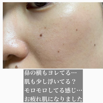 ディオールスキン フォーエヴァー フルイド グロウ/Dior/リキッドファンデーションを使ったクチコミ(5枚目)