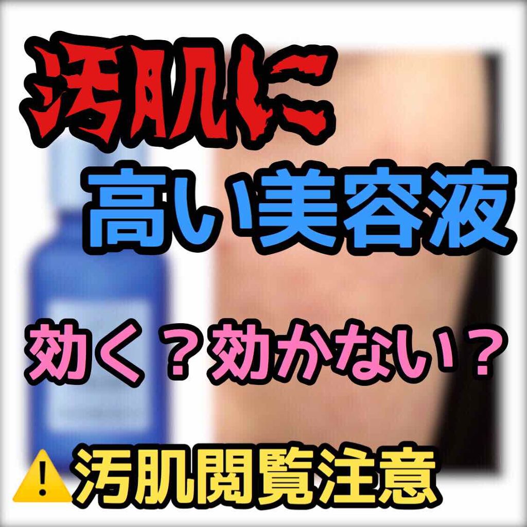 タカミスキンピール/タカミ/ブースター・導入液を使ったクチコミ(1枚目)