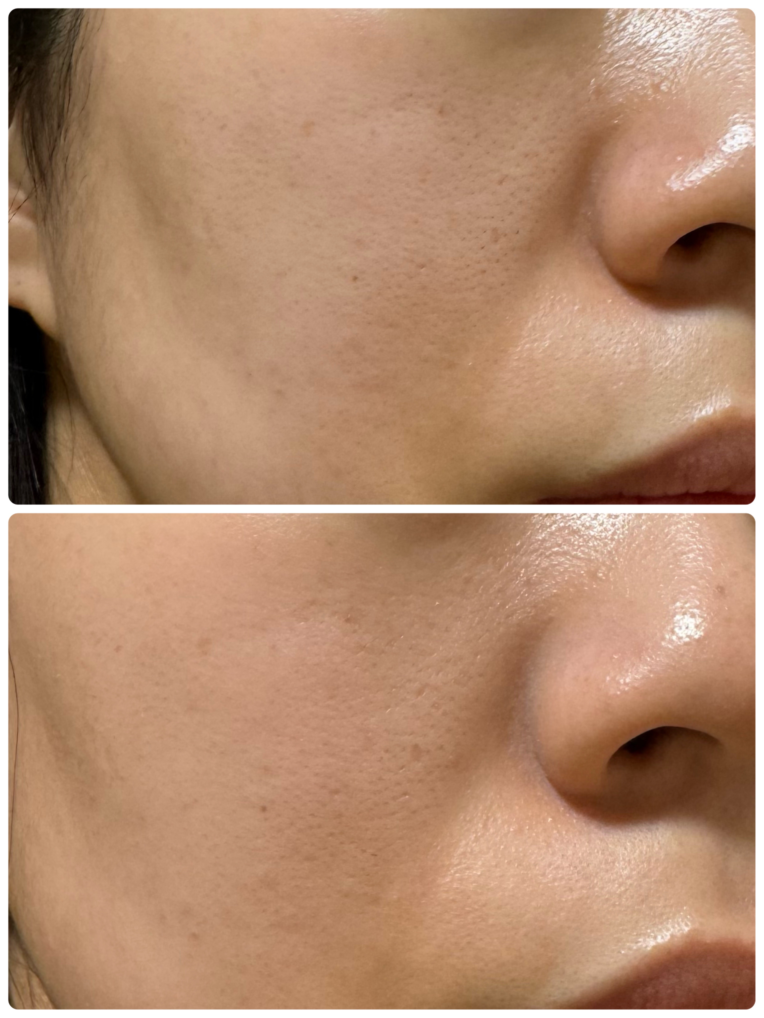 デューイーメッシュファンデーション/ASUNE /クッションファンデーションを使ったクチコミ（2枚目）