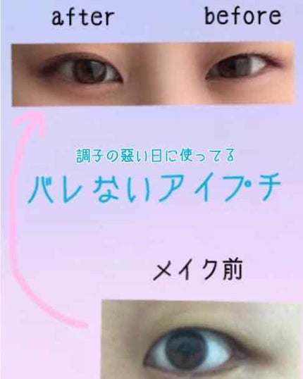 【旧品】オリシキ アイリッドスキンフィルム/D-UP/二重まぶた用アイテムを使ったクチコミ(1枚目)