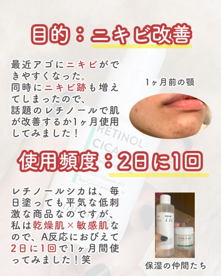 レチノール シカ リペア セラム/innisfree/美容液を使ったクチコミ(4枚目)