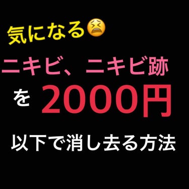 気になる😫
ニキビ、ニキビ跡を2000円以下で消し去る方法！

ということで、
私自身の体験をもとでニキビ、ニキビ跡を消し去る方法をお伝えしていきたいと思います！


私はニキビがストレスと便秘のせいで