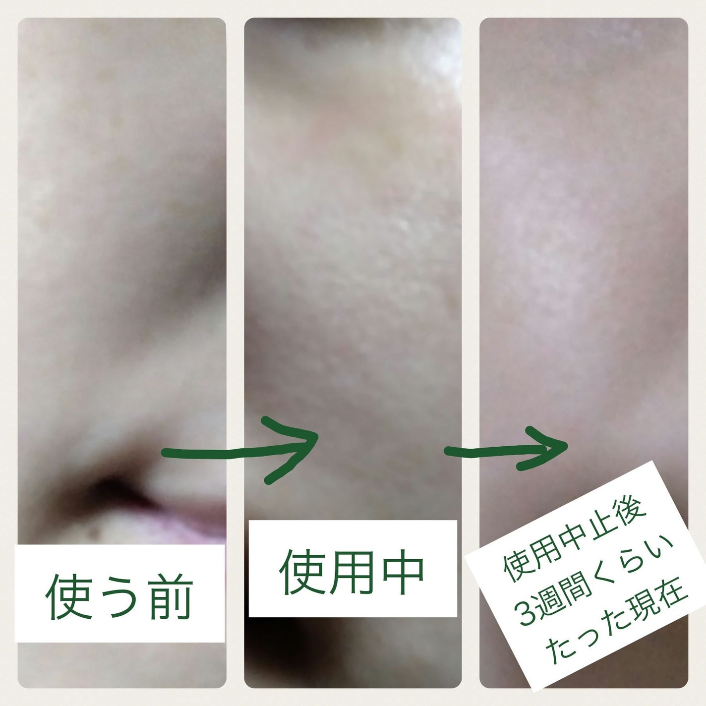 プロバイオダーム リフティング クリーム/BIOHEAL BOH/フェイスクリームを使ったクチコミ(2枚目)