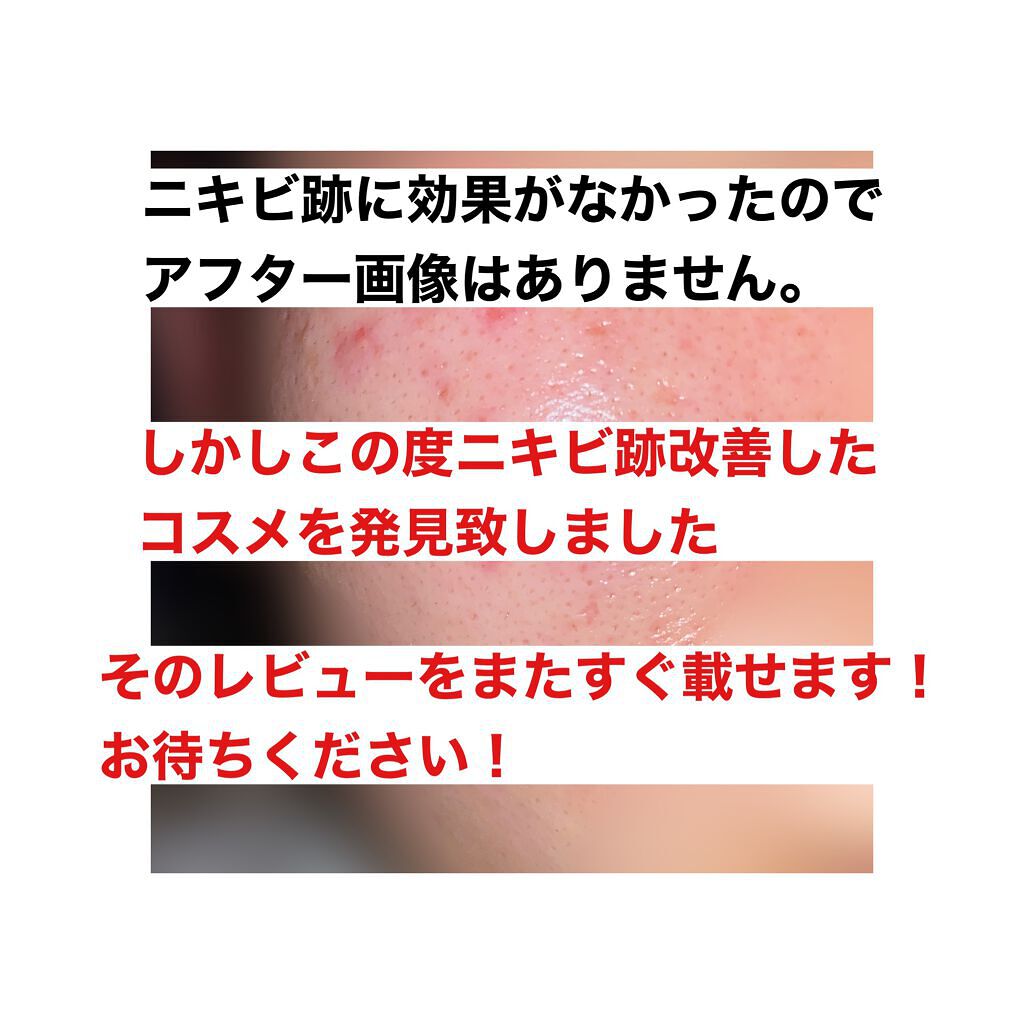 薬用 しみ 集中対策 美容液/メラノCC/美容液を使ったクチコミ(3枚目)