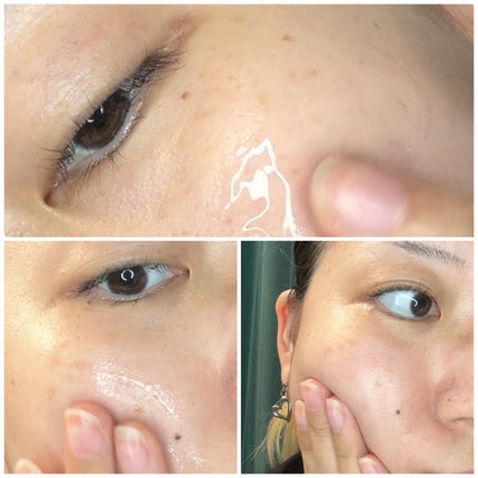 EXO THE LAB.SERUM/EXO THE LAB./美容液を使ったクチコミ(5枚目)