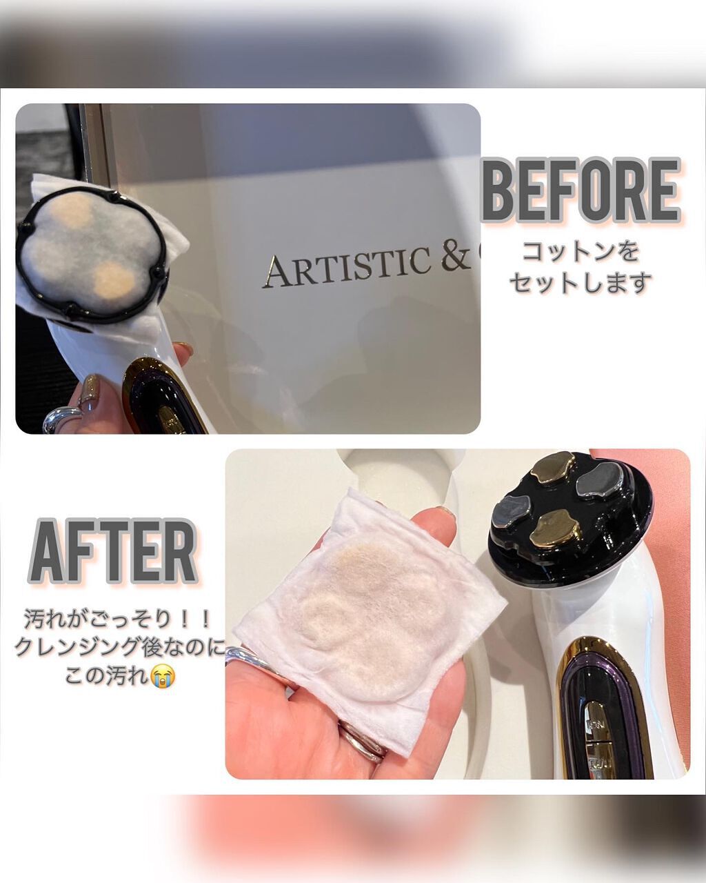 Miss Arrivo THE WRAITH/ARTISTIC&CO./美顔器・マッサージを使ったクチコミ(5枚目)