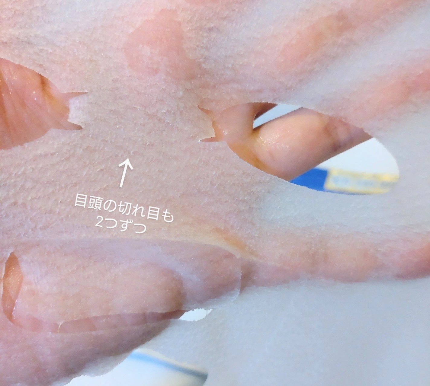 毛穴小町 テカリ源治 マスク/クリアターン/シートマスク・パックを使ったクチコミ(5枚目)