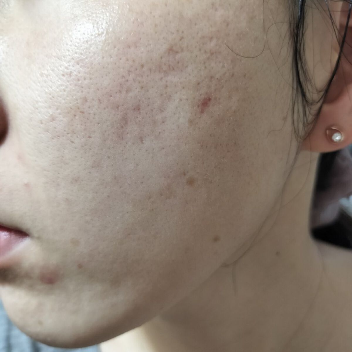 ワセリンHG チューブ (化粧用油)/大洋製薬/ボディクリームを使ったクチコミ（1枚目）