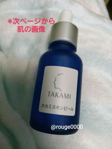 
タカミスキンピール 

☆使い切りました。最終編集です。

インスタでよく見たので。
怪しいと思いつつ気になったので購入。

※画像は使用4日目のものです。
おでこの凸凹と小鼻の赤み、毛穴が悩み。ニキ