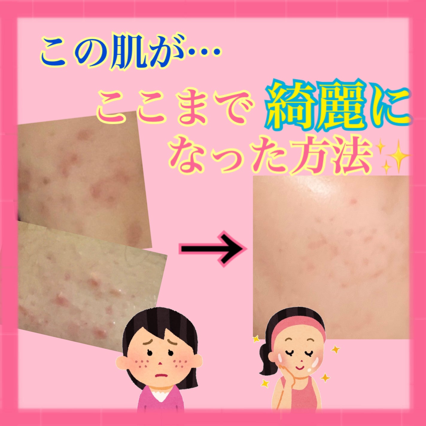 â¡ ð â¡ on LIPS ãä»åã¯ããããã綺éºã«ãªã£ãæ¹æ³ãã玹ä»ããŸãâšïžå®éç§ã¯ãã..ãïŒ1æç®ïŒ