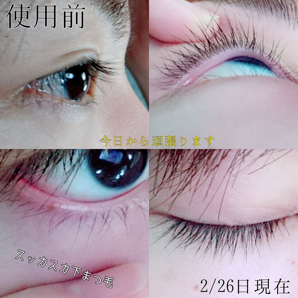 EMAKED（エマーキット）/水橋保寿堂製薬/まつげ美容液を使ったクチコミ（3枚目）