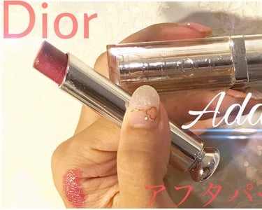 【旧】ディオール アディクト リップスティック/Dior/口紅を使ったクチコミ（1枚目）