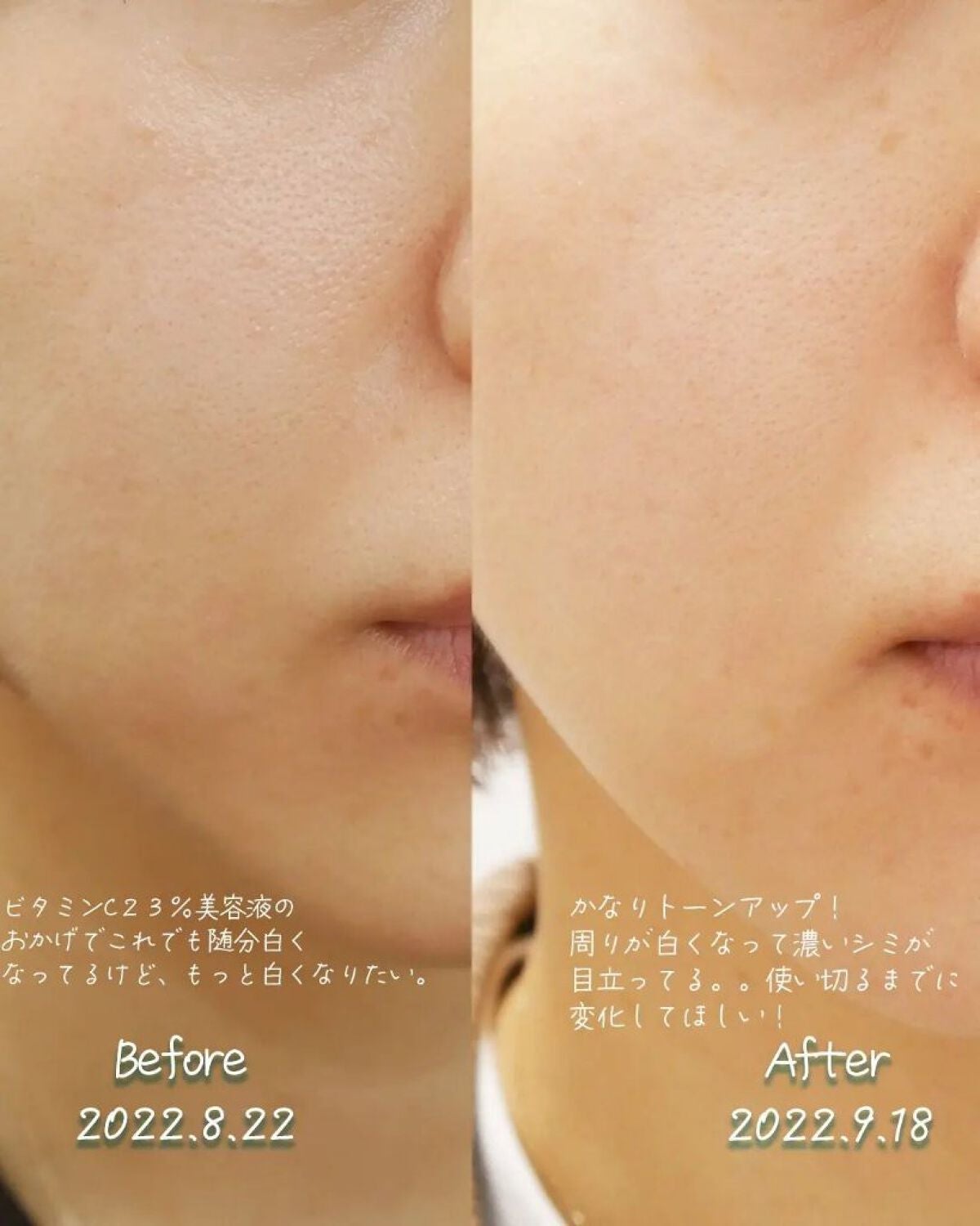 TX-アンプルクレンザー/Dr.Melaxin/美容液を使ったクチコミ(3枚目)