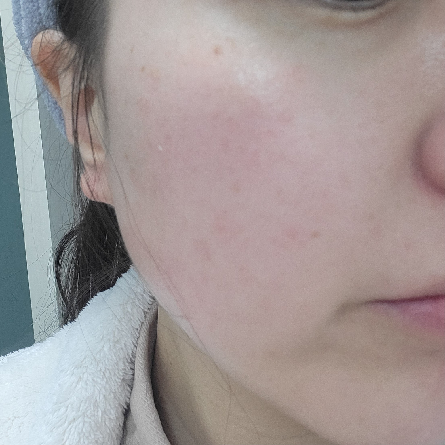 ユース ラディアンス ビタチノール セラム/primera/美容液を使ったクチコミ（3枚目）