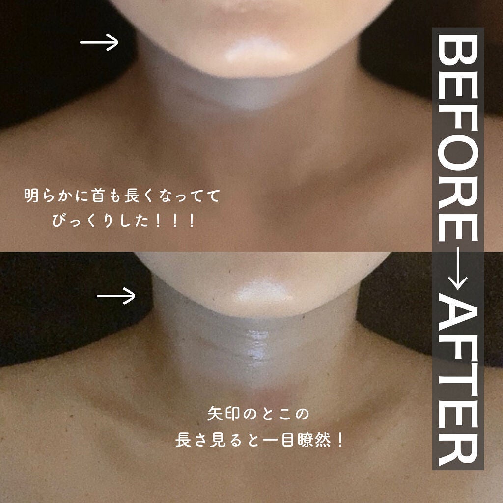 アフリカ少女🐘モテコスメ on LIPS 「【小顔】\話題のコルギ、実際に行って本音レポ/結果、顔が小さく..」(5枚目)