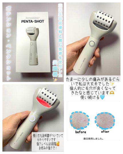 試してみた】ペンタショット CELORABYのリアルな口コミ 試してみた】ペンタショット CELORABYのリアルな口コミ