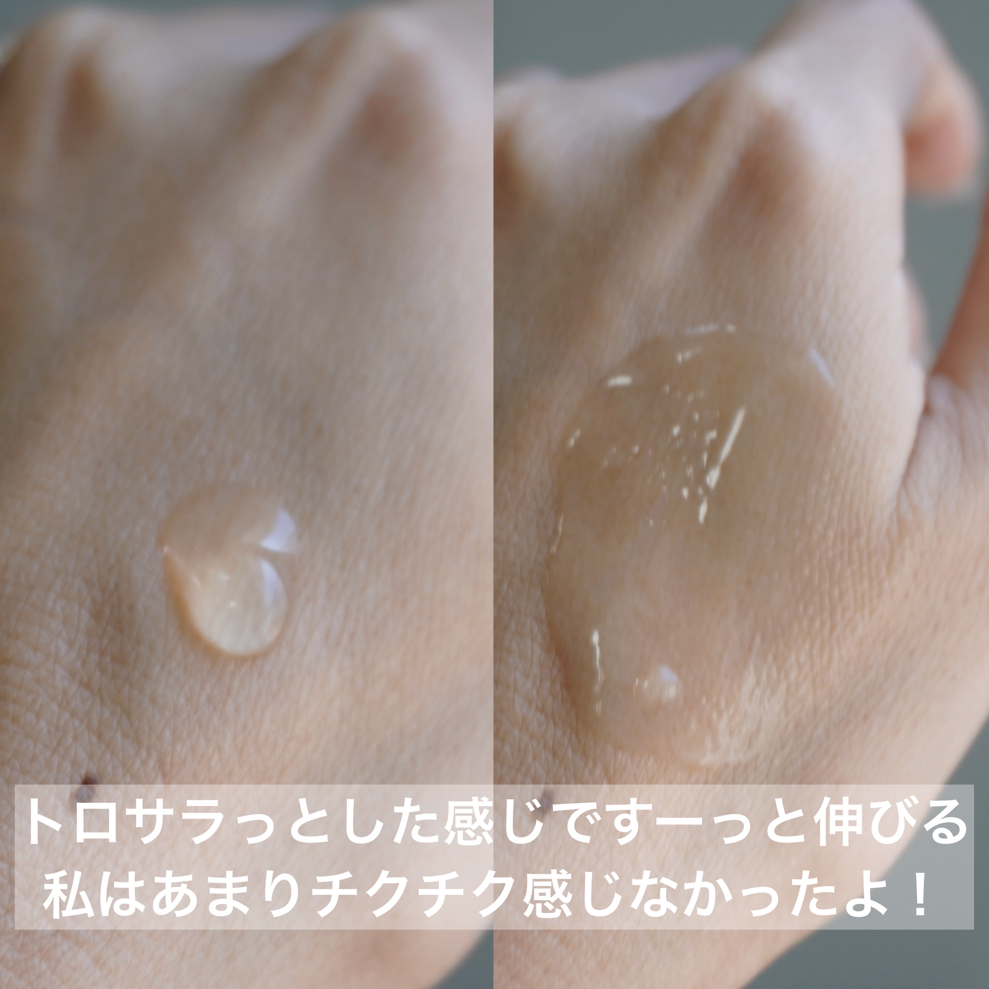 リードルリッチ パワーニードルセラム/REEDLE RICH/美容液を使ったクチコミ（2枚目）