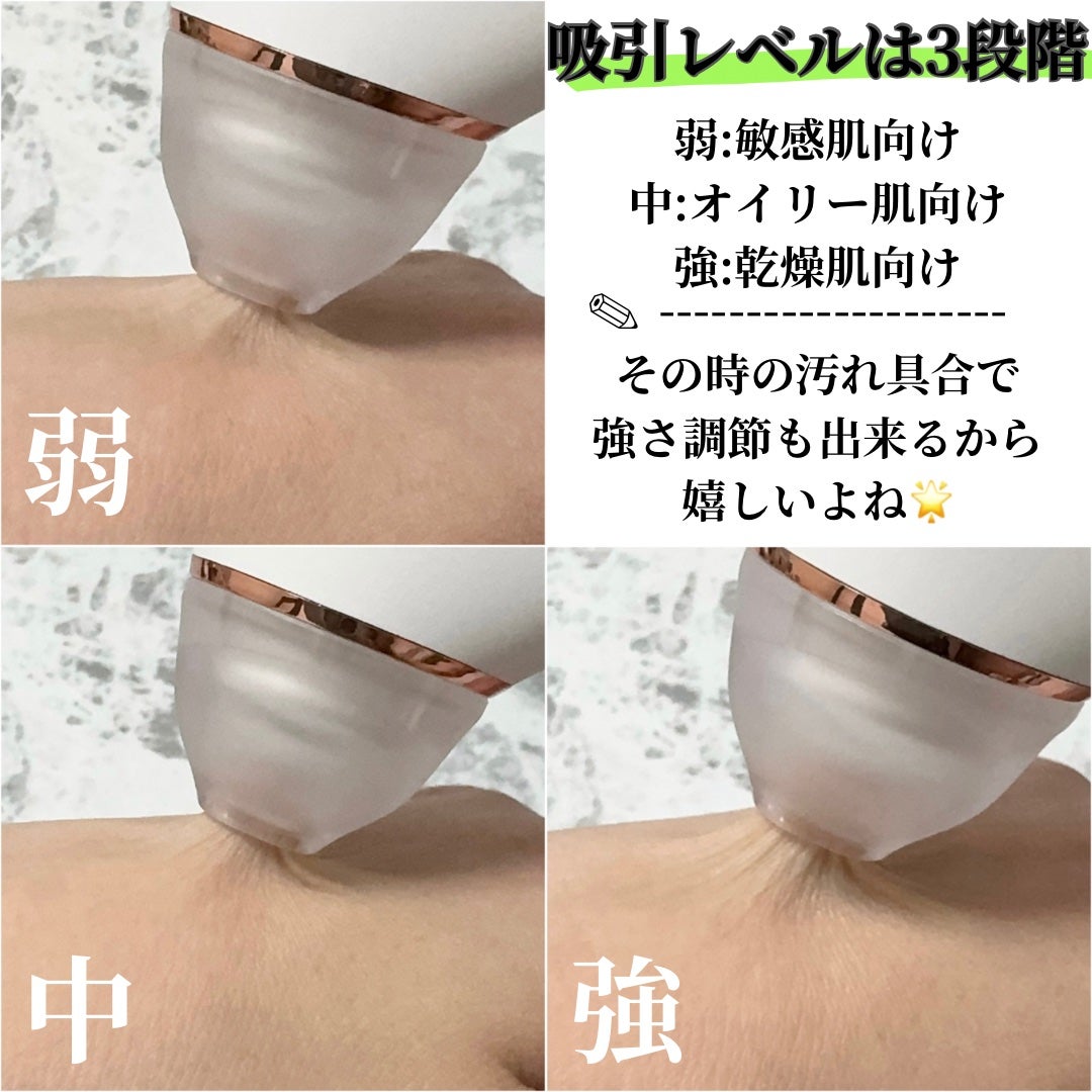 アレティ ポアスコープ/Areti./美顔器・マッサージを使ったクチコミ(4枚目)