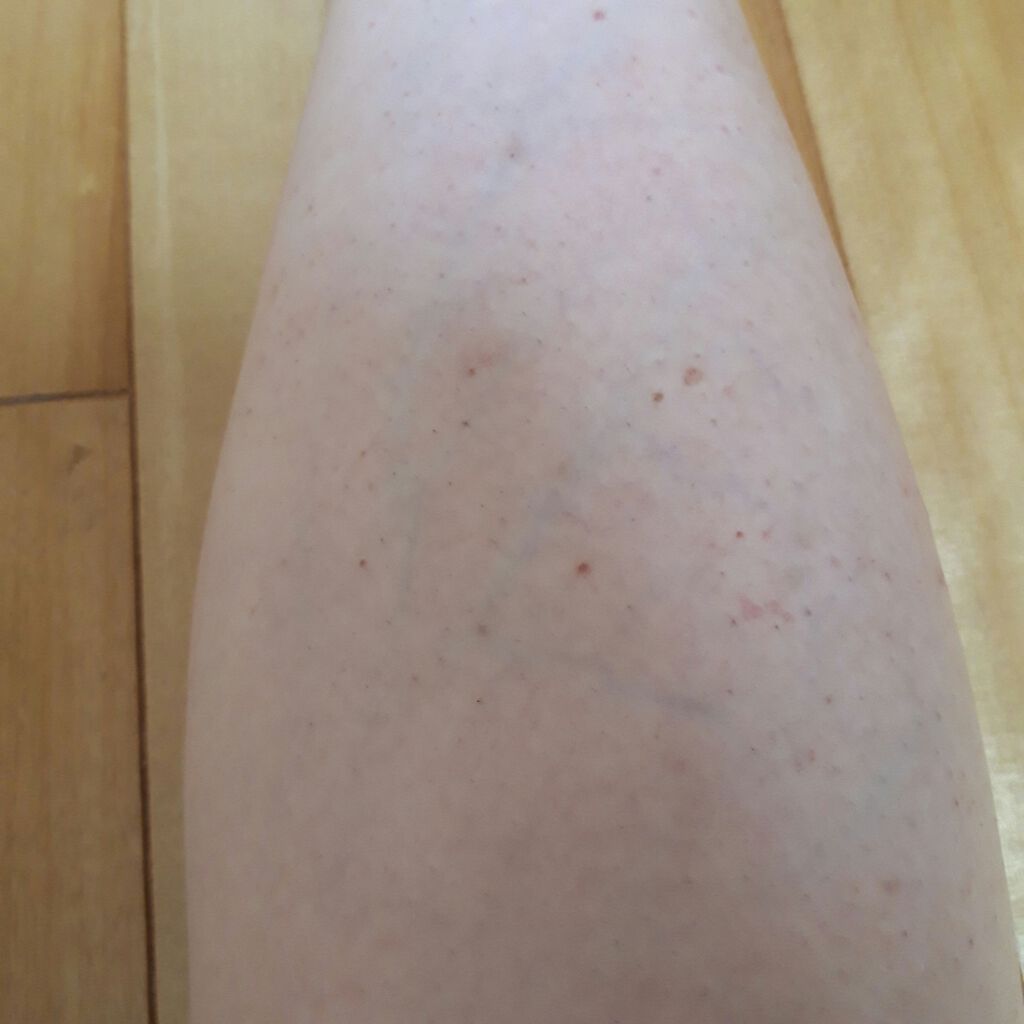 バスタイム除毛クリーム 敏感肌用/Veet/除毛クリームを使ったクチコミ(4枚目)