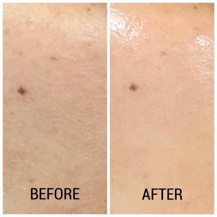 ヒアルブースターアンプル /NACIFIC/美容液を使ったクチコミ(3枚目)