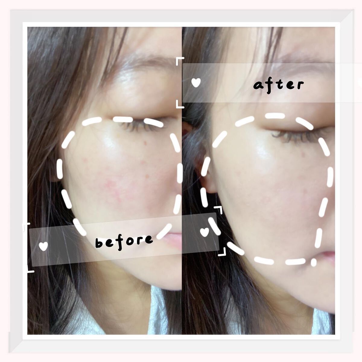 デザイニング コンシーラー/ブリリアージュ/リキッドコンシーラーを使ったクチコミ(4枚目)