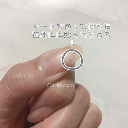 シルクラップ <欠け爪専用補強シール>/マニケアー/ネイル用品を使ったクチコミ(2枚目)