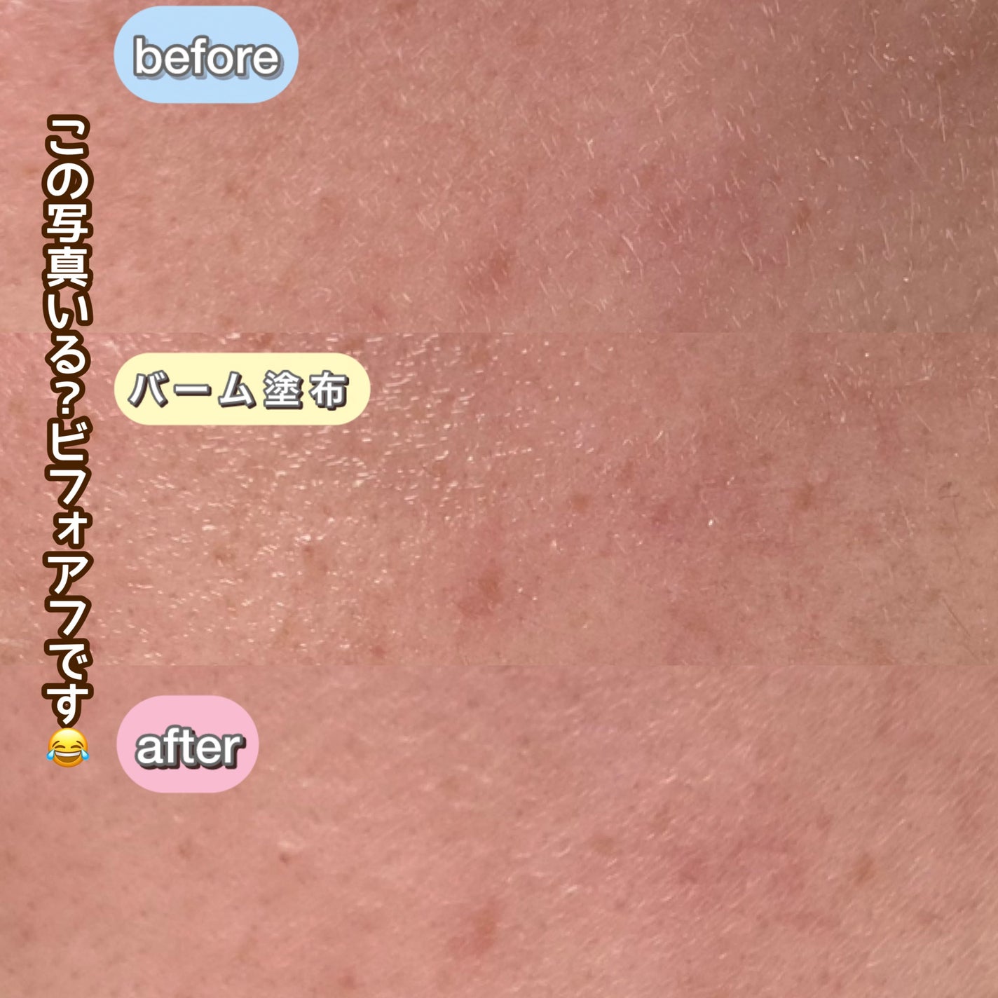 サロンプラス トーンアップ フェイススムーサー ホルダー(刃付き)/サロンプラス/シェーバーを使ったクチコミ(3枚目)