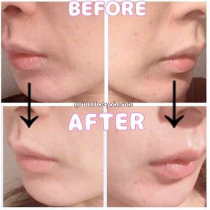 HA マイクロマスク/MAGIE LAB/シートマスク・パックを使ったクチコミ(4枚目)