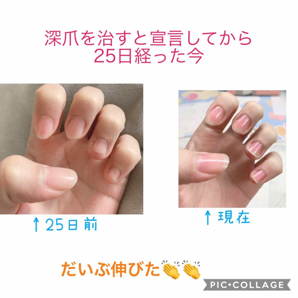 エテュセ クイックケアコート/ettusais/ネイルオイル・トリートメントを使ったクチコミ(1枚目)