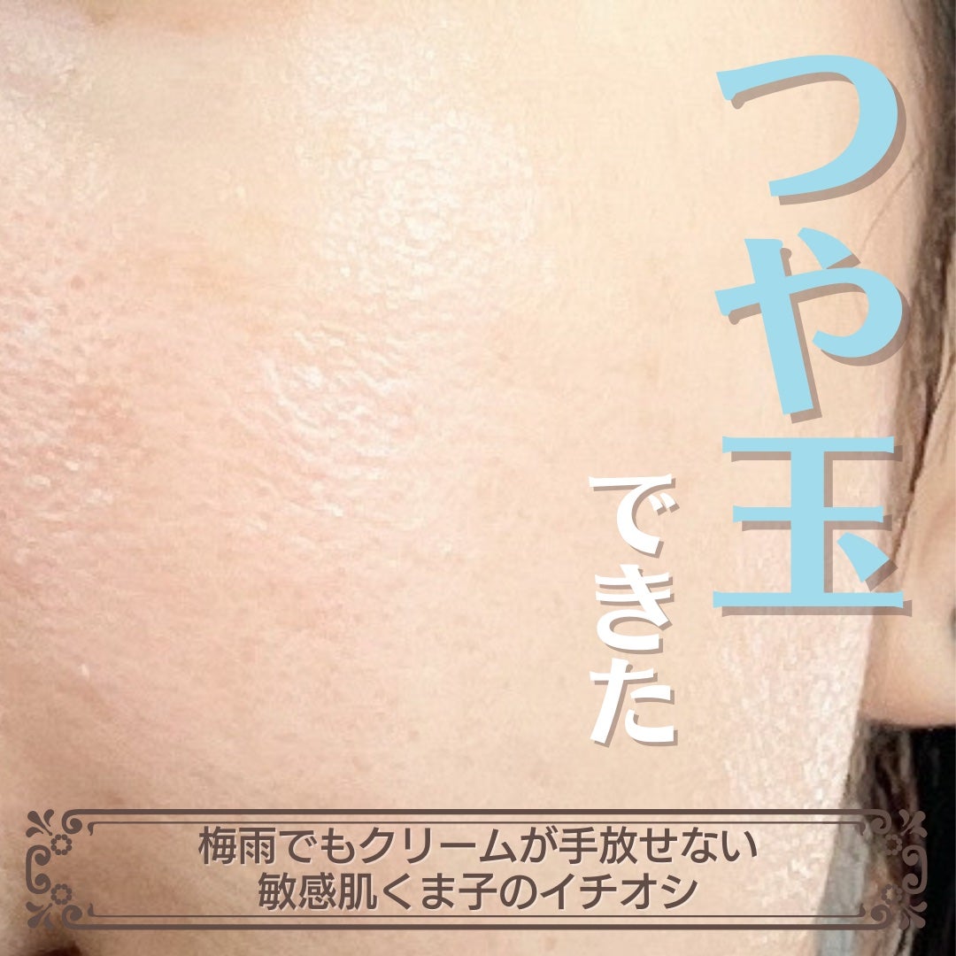 メディプラスゲル/メディプラス/オールインワン化粧品を使ったクチコミ(1枚目)