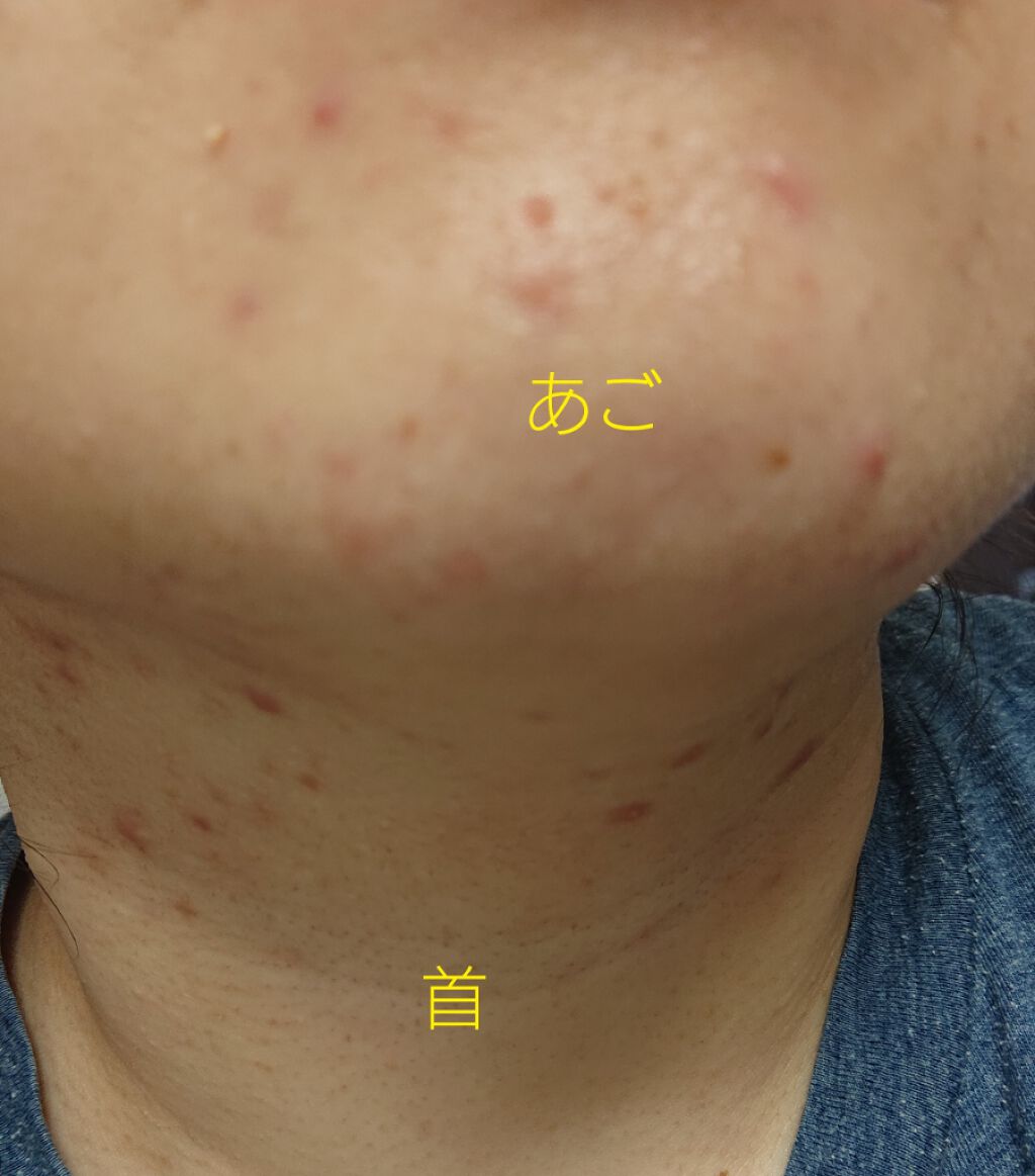 高品位「スクワラン」/HABA/フェイスオイルを使ったクチコミ(3枚目)